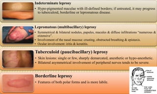 Indeterminate leprosy
• Hypo-pigmented maculae with ill-defined borders; if untreated, it may progress
to tuberculoid, borderline or lepromatous disease.
Lepromatous (multibacillary) leprosy
• Symmetrical & bilateral nodules, papules, macules & diffuse infiltrations “numerous &
extensive”.
• Involvement of the nasal mucosa: crusting, obstructed breathing & epistaxis.
• Ocular involvement: iritis & keratitis.
Tuberculoid (paucibacillary) leprosy
• Skin lesions: single or few, sharply demarcated, anesthetic or hypo-anesthetic.
• Bilateral asymmetrical involvement of peripheral nerves tends to be severe.
Borderline leprosy
• Features of both polar forms and is more labile.
 