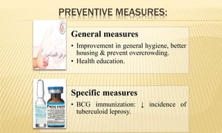 PREVENTIVE MEASURES:
General measures
• Improvement in general hygiene, better
housing & prevent overcrowding.
• Health education.
Specific measures
• BCG immunization: ↓ incidence of
tuberculoid leprosy.
 