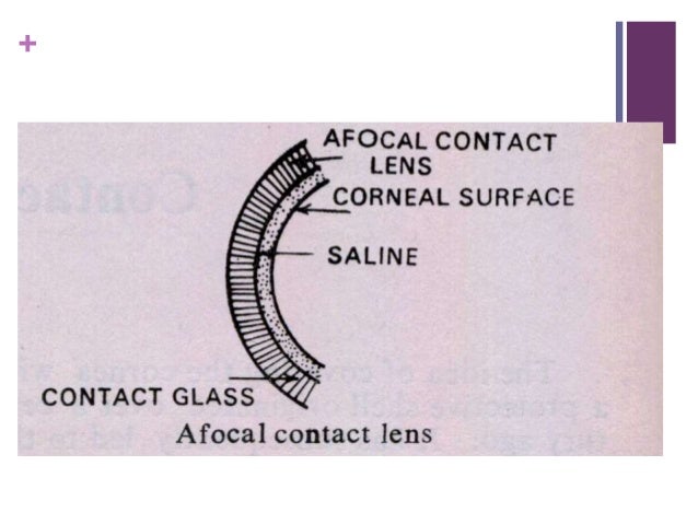 Contact Lens Contact Lens