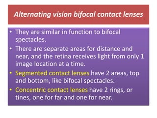 Alternating vision bifocal contact lenses
• They are similar in function to bifocal
spectacles.
• There are separate areas for distance and
near, and the retina receives light from only 1
image location at a time.
• Segmented contact lenses have 2 areas, top
and bottom, like bifocal spectacles.
• Concentric contact lenses have 2 rings, or
tines, one for far and one for near.
 
