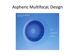 Aspheric MultifocaL Design
 