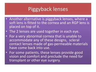Piggyback lenses
• Another alternative is piggyback lenses, where a
soft lens is fitted to the cornea and an RGP lens is
placed on top of it.
• The 2 lenses are used together in each eye.
• For a very abnormal cornea that is unable to
accommodate any of these designs, scleral
contact lenses made of gas-permeable materials
have come back into use.
• For some patients, these lenses provide good
vision and comfort and preclude the need for
transplant or other eye surgery.
 