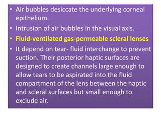 • Air bubbles desiccate the underlying corneal
epithelium.
• Intrusion of air bubbles in the visual axis.
• Fluid-ventilated gas-permeable scleral lenses
• It depend on tear- fluid interchange to prevent
suction. Their posterior haptic surfaces are
designed to create channels large enough to
allow tears to be aspirated into the fluid
compartment of the lens between the haptic
and scleral surfaces but small enough to
exclude air.
 