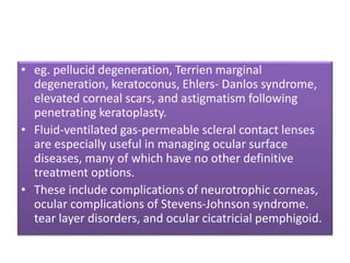 • eg. pellucid degeneration, Terrien marginal
degeneration, keratoconus, Ehlers- Danlos syndrome,
elevated corneal scars, and astigmatism following
penetrating keratoplasty.
• Fluid-ventilated gas-permeable scleral contact lenses
are especially useful in managing ocular surface
diseases, many of which have no other definitive
treatment options.
• These include complications of neurotrophic corneas,
ocular complications of Stevens-Johnson syndrome.
tear layer disorders, and ocular cicatricial pemphigoid.
 