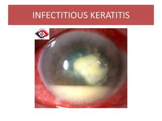 INFECTITIOUS KERATITIS
 