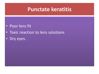 Punctate keratitis
• Poor lens fit
• Toxic reaction to lens solutions
• Dry eyes.
 