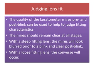 Judging lens fit
• The quality of the keratometer mires pre- and
post-blink can be used to help to judge fitting
characteristics.
• The mires should remain clear at all stages.
• With a steep fitting lens, the mires will look
blurred prior to a blink and clear post-blink.
• With a loose fitting lens, the converse will
occur.
 