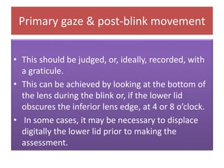 Primary gaze & post-blink movement
• This should be judged, or, ideally, recorded, with
a graticule.
• This can be achieved by looking at the bottom of
the lens during the blink or, if the lower lid
obscures the inferior lens edge, at 4 or 8 o’clock.
• In some cases, it may be necessary to displace
digitally the lower lid prior to making the
assessment.
 