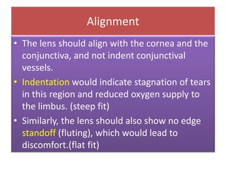 Alignment
• The lens should align with the cornea and the
conjunctiva, and not indent conjunctival
vessels.
• Indentation would indicate stagnation of tears
in this region and reduced oxygen supply to
the limbus. (steep fit)
• Similarly, the lens should also show no edge
standoff (fluting), which would lead to
discomfort.(flat fit)
 