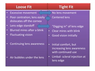 Loose Fit
• Excessive movement
• Poor centration; lens easily
dislocates off the cornea
• Lens edge standoff
• Blurred mires after a blink
• Fluctuating vision
• Continuing lens awareness
• Air bubbles under the lens
Tight Fit
• No lens movement
• Centered lens
• "Digging in" of lens edge
• Clear mires with blink
• Good vision initially
• Initial comfort, but
increasing lens awareness
with continued use
• Limbal- scleral injection at
lens edge
 