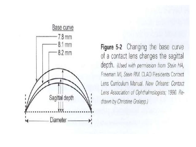 Contact Lens Base Curve Chart