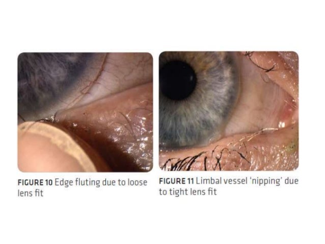 When Will Opticians Reopen In The Uk New Rules Customers