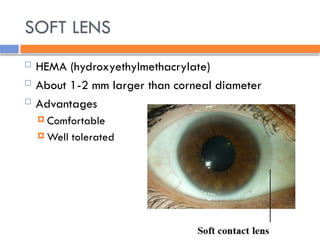 SOFT LENS
 HEMA (hydroxyethylmethacrylate)
 About 1-2 mm larger than corneal diameter
 Advantages
 Comfortable
 Well tolerated
 
