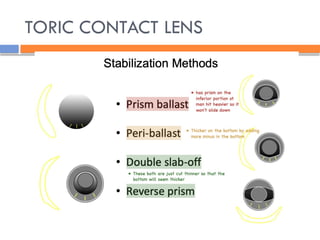 TORIC CONTACT LENS
 