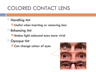 COLORED CONTACT LENS
 Handling tint
 Useful when inserting or removing lens
 Enhancing tint
 Makes light coloured eyes more vivid
 Opaque tint
 Can change colour of eyes
 