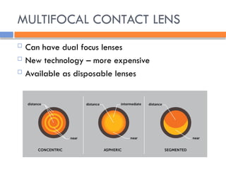 MULTIFOCAL CONTACT LENS
 Can have dual focus lenses
 New technology – more expensive
 Available as disposable lenses
 