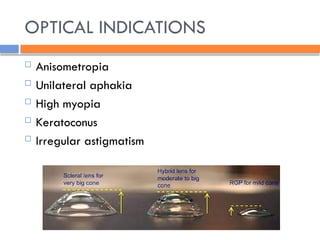 OPTICAL INDICATIONS
 Anisometropia
 Unilateral aphakia
 High myopia
 Keratoconus
 Irregular astigmatism
 