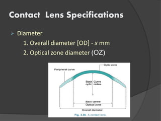 Contact Lens Specifications
 Diameter
1. Overall diameter [OD] - x mm
2. Optical zone diameter (OZ)
 