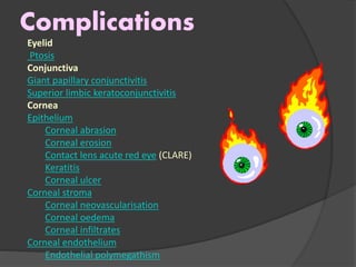 Complications
Eyelid
Ptosis
Conjunctiva
Giant papillary conjunctivitis
Superior limbic keratoconjunctivitis
Cornea
Epithelium
Corneal abrasion
Corneal erosion
Contact lens acute red eye (CLARE)
Keratitis
Corneal ulcer
Corneal stroma
Corneal neovascularisation
Corneal oedema
Corneal infiltrates
Corneal endothelium
Endothelial polymegathism
 