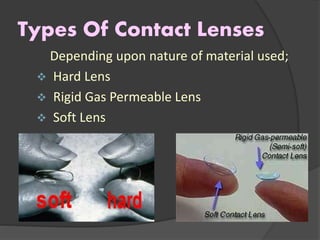 Types Of Contact Lenses
Depending upon nature of material used;
 Hard Lens
 Rigid Gas Permeable Lens
 Soft Lens
 
