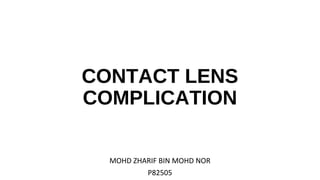 CONTACT LENS
COMPLICATION
MOHD ZHARIF BIN MOHD NOR
P82505
 