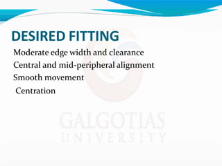 DESIRED FITTING
Moderate edge width and clearance
Central and mid-peripheral alignment
Smooth movement
Centration
 
