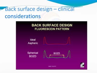 Back surface design – clinical
considerations
 
