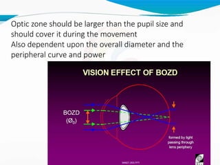 Optic zone should be larger than the pupil size and
should cover it during the movement
Also dependent upon the overall diameter and the
peripheral curve and power
 