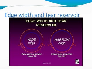 Edge width and tear reservoir
 