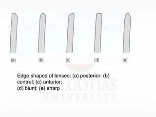 Edge shapes of lenses: (a) posterior; (b)
central; (c) anterior;
(d) blunt; (e) sharp
 