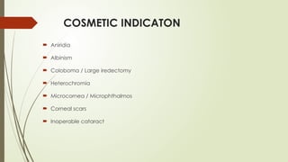 COSMETIC INDICATON
 Aniridia
 Albinism
 Coloboma / Large iredectomy
 Heterochromia
 Microcornea / Microphthalmos
 Corneal scars
 Inoperable cataract
 