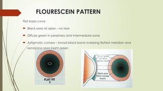 FLOURESCEIN PATTERN
Flat base curve
 Black area at apex – no tear
 Diffuse green in periphery and intermediate zone
 Astigmatic cornea – broad black band overlying flattest meridian and
remaining area bight green
FLAT FIT
 