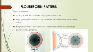 FLOURESCEIN PATTERN
Steep base curve
 Pooling of tear fluid in apex – bright green central area
 Bright green peripheral band and broad black intermediate zone (heavy
touch)
 Astigmatic cornea –black crescent under intermediate zone and bight
green centre & periphery
STEEP FIT
 
