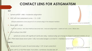 CONTACT LENS FOR ASTIGMATISM
RGP
1. Spherical RGP – Mild – moderate astigmatism
2. RGP with toric peripheral curves – 1.5 – 2.5D
Steeper peripheral curves (equal to D of corneal astig) in the steepest meridian
3. Bitoric RGP- >2.5D
Post toric surface – lens tear interface becomes toric - induced astigmatism – addnl ant toric curve – Bitoric lens
4. Front surface Toric RGP
spherical cornea with significant Lenticular astig – residual astig: spl change in shape to prevent rotation of cyl
axis – Prism blast (base down prism 1.5D), truncated (edge is cut short in 1 meridian by 0.5-1mm)
Soft CL
5. Spherical soft CL (upto 1D and total astig < 1/3rd
of sph correction)
6. Toric soft CL (>1D) Prism blast, truncation, combined, Double slab off
 
