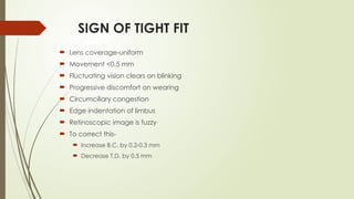 SIGN OF TIGHT FIT
 Lens coverage-uniform
 Movement <0.5 mm
 Fluctuating vision clears on blinking
 Progressive discomfort on wearing
 Circumciliary congestion
 Edge indentation of limbus
 Retinoscopic image is fuzzy
 To correct this-
 Increase B.C. by 0.2-0.3 mm
 Decrease T.D. by 0.5 mm
 