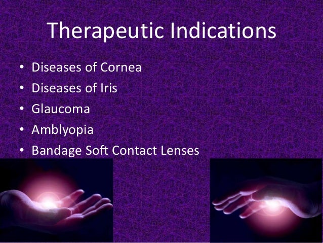 Contact lenses