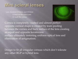 Lens diameter:15.0mm and 18.0mm
1) bear on the sclera and
2) vault the cornea
Cornea is completely vaulted and almost perfect
opposite corneal shape is created by tears pooling
between the cornea and back surface of the lens creating
an equal and opposite keratoconic
surface ultimately restoring uniform optical lens and
elimination of astigmatism.
Design to fit all irregular corneas which don’t tolerate
any other RGP or hybrid lens.
 
