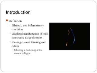 Introduction
Definition
◦ Bilateral, non inflammatory
condition
◦ Localized manifestation of mild
connective tissue disorder
◦ Causing corneal thinning and
ectasia
 following a weakening of the
corneal collagen
 