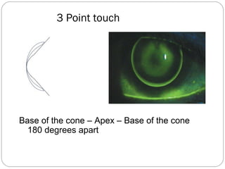 3 Point touch
Base of the cone – Apex – Base of the cone
180 degrees apart
 