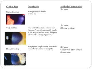 Clinical Sign
Corneal nerves
Vogt’s striae
Fleischer’s ring
Description
More prominent than in
normal eye
Fine vertical lines in the stroma and
Descemet’s membrane, usually parallel
to the steep axis of the cone, disappear
temporarily on digital pressure.
Iron pigment ring forms the base of the
cone. May be partial or complete.
Method of examination
Slit lamp
Slit lamp
(Optical section)
Slit lamp
Cobalt blue filter. Diffuse
illumination
 
