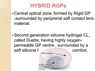 Contact lenses in Ophthalmology | PPTX