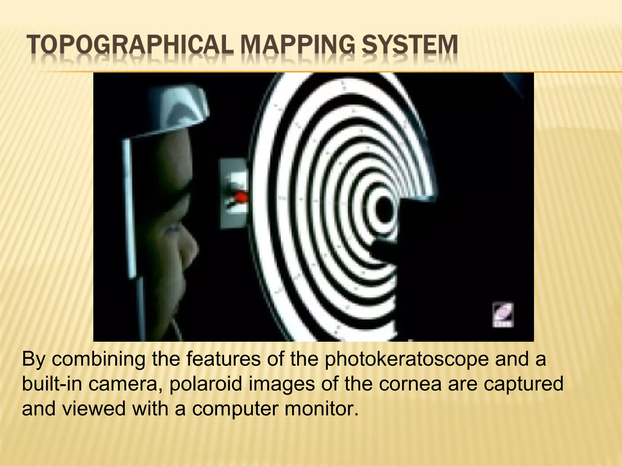 By combining the features of the photokeratoscope and a
built-in camera, polaroid images of the cornea are captured
and viewed with a computer monitor.
 