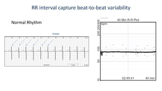 AI for contactless cardiology | PDF