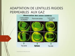 ADAPTATION DE LENTILLES RIGIDES
PERMEABLES AUX GAZ
DOUIBI NAJLAE IPIAB 2022/2023
1
 