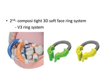 • 2nd- composi tight 3D soft face ring system
- V3 ring system
 