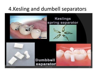 4.Kesling and dumbell separators
 