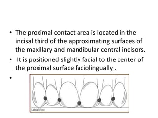 • The proximal contact area is located in the
incisal third of the approximating surfaces of
the maxillary and mandibular central incisors.
• It is positioned slightly facial to the center of
the proximal surface faciolingually .
•
 