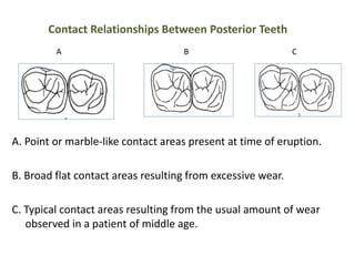 Contact Relationships Between Posterior Teeth
A. Point or marble-like contact areas present at time of eruption.
B. Broad flat contact areas resulting from excessive wear.
C. Typical contact areas resulting from the usual amount of wear
observed in a patient of middle age.
A B C
 