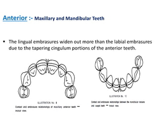 Anterior :- Maxillary and Mandibular Teeth
 The lingual embrasures widen out more than the labial embrasures
due to the tapering cingulum portions of the anterior teeth.
 