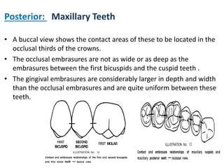 Posterior: Maxillary Teeth
• A buccal view shows the contact areas of these to be located in the
occlusal thirds of the crowns.
• The occlusal embrasures are not as wide or as deep as the
embrasures between the first bicuspids and the cuspid teeth .
• The gingival embrasures are considerably larger in depth and width
than the occlusal embrasures and are quite uniform between these
teeth.
 